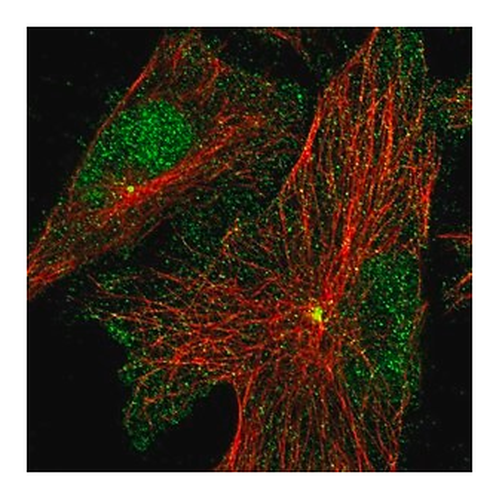 Merck Anti-PRICKLE3 antibody produced in rabbit