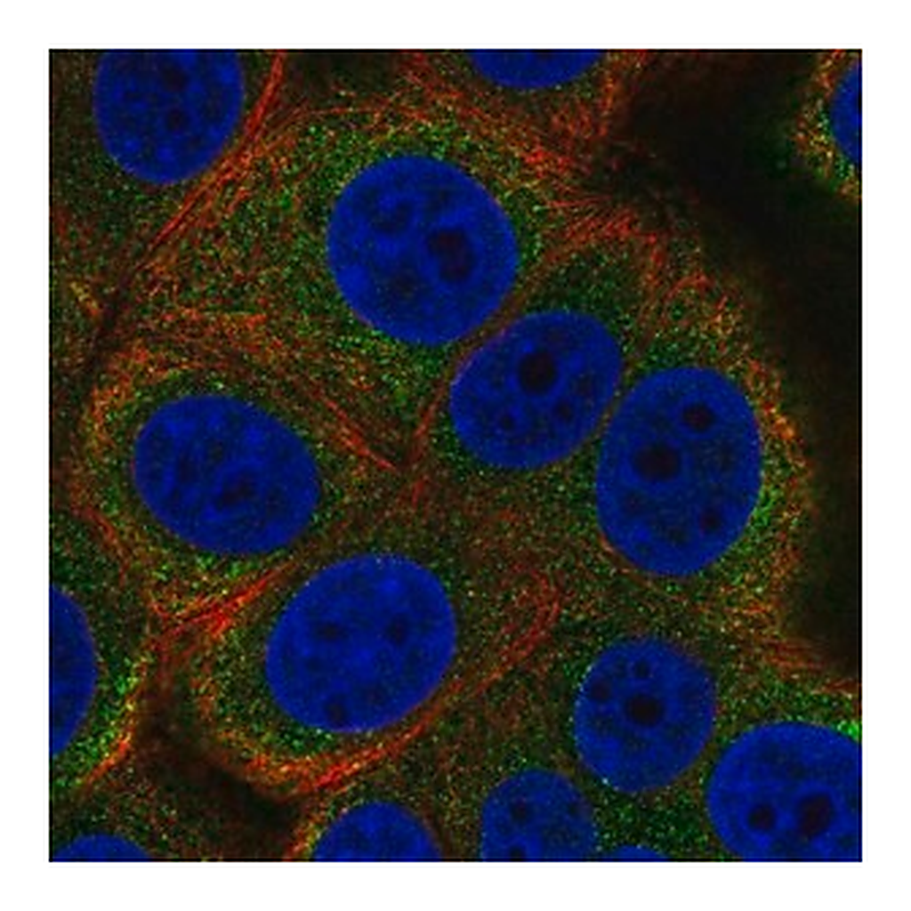 Merck Anti-ALG12 antibody produced in rabbit