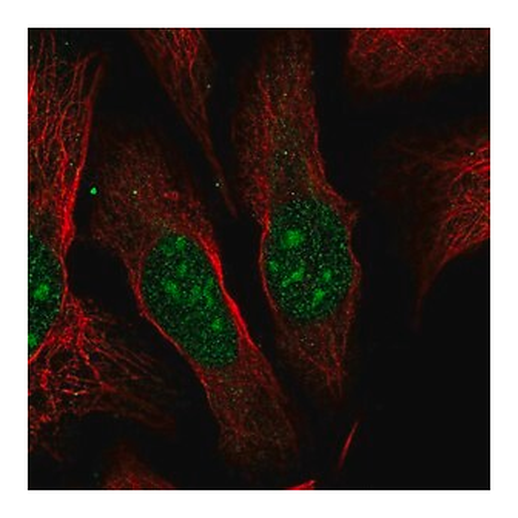 Merck Anti-ESF1 antibody produced in rabbit