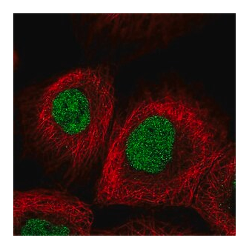 Merck Anti-METTL1 antibody produced in rabbit