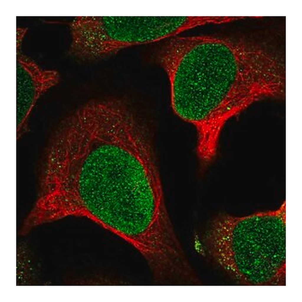 Merck Anti-MTBP antibody produced in rabbit