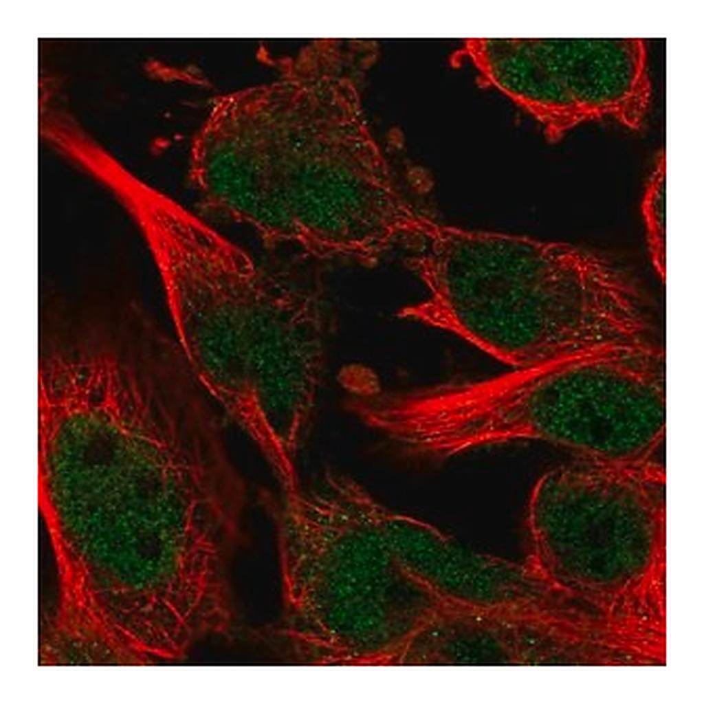 Merck Anti-ZNF655 antibody produced in rabbit