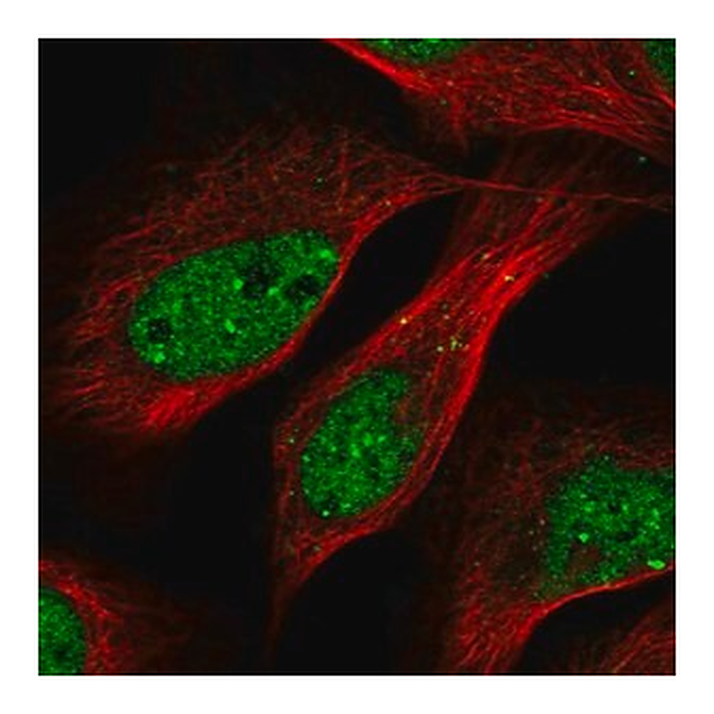 Merck Anti-TRIP4 antibody produced in rabbit