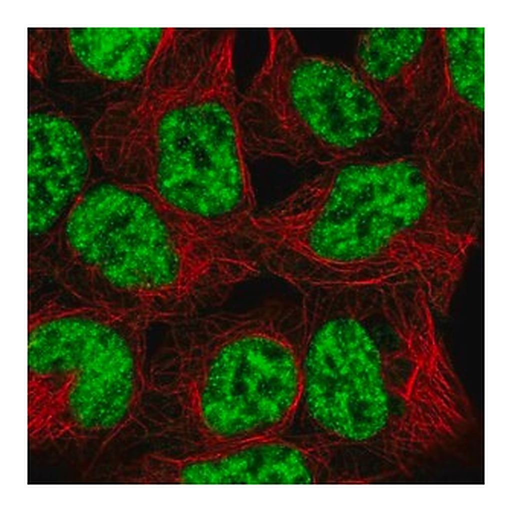 Merck Anti-SNRPB2 antibody produced in rabbit