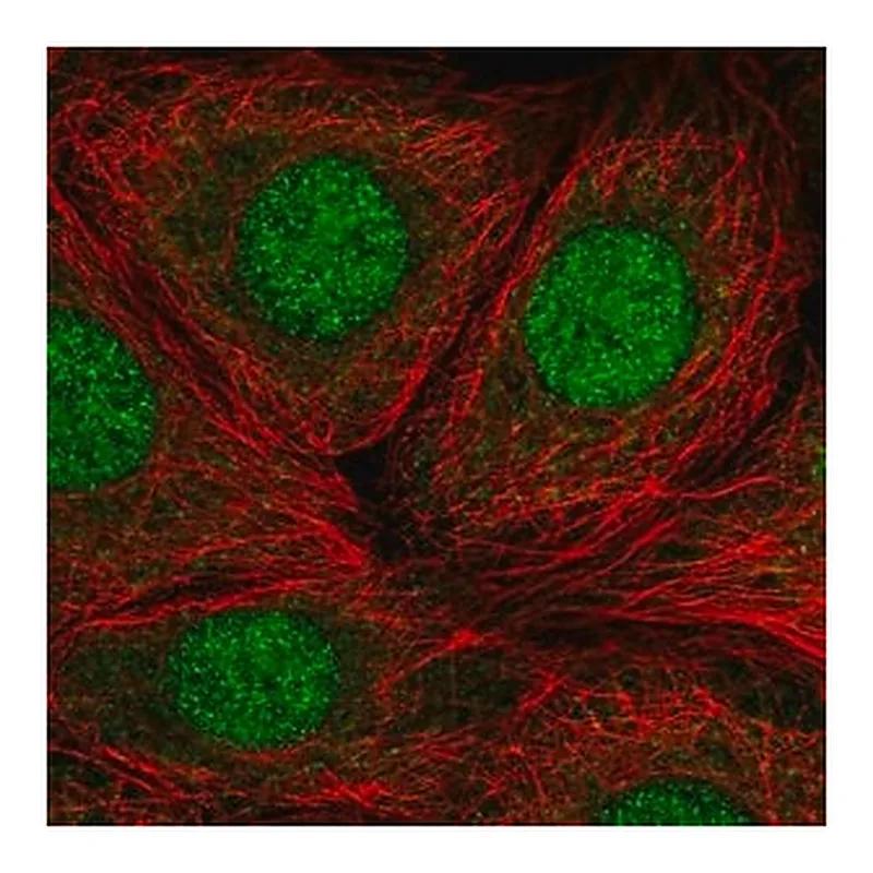 Merck Anti-RP9 antibody produced in rabbit