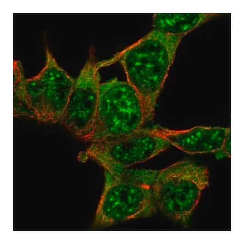 Merck Anti-AKAP17A antibody produced in rabbit
