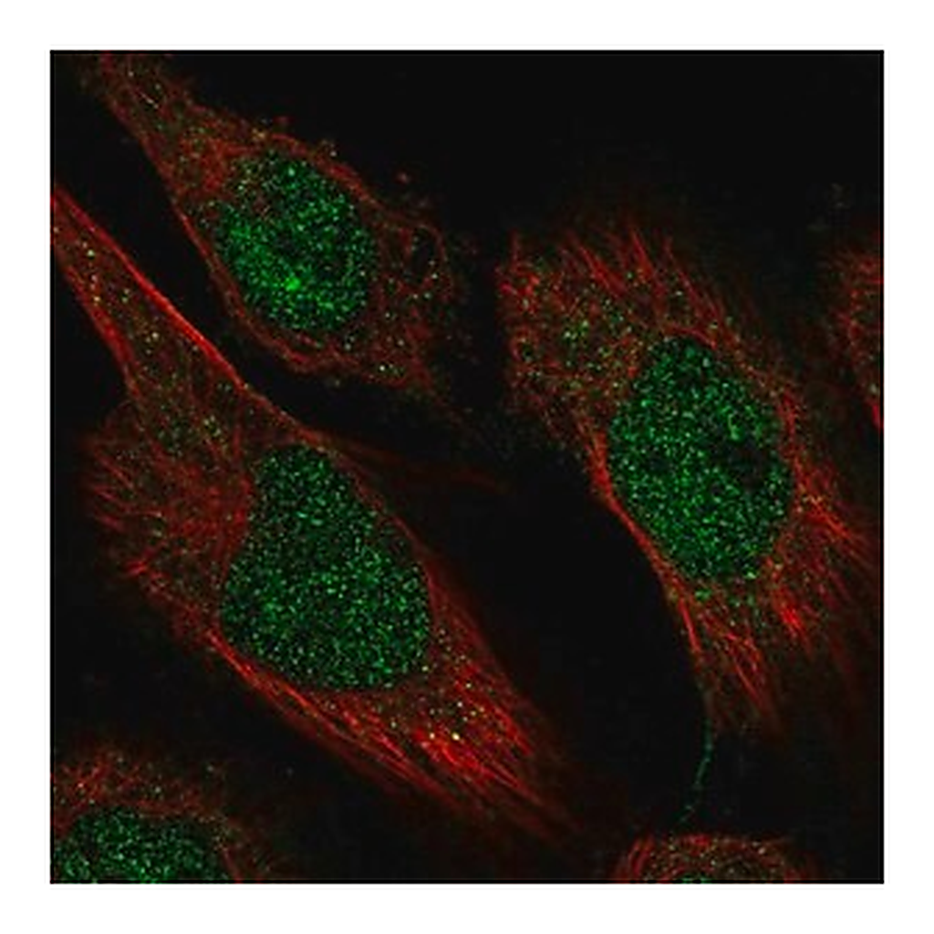 Merck Anti-CAMTA2 antibody produced in rabbit