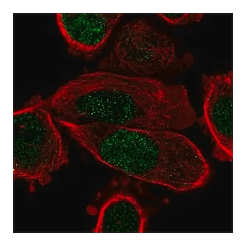 Merck Anti-PPARG antibody produced in rabbit