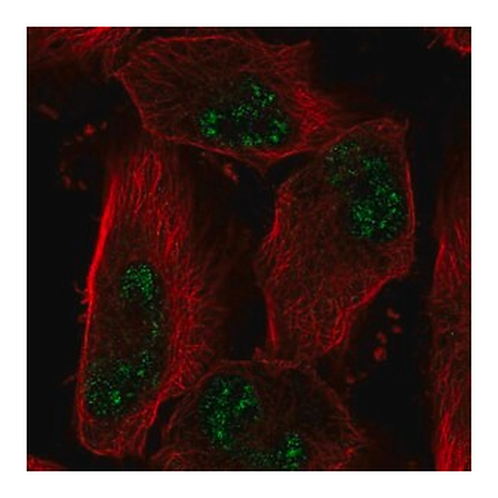 Merck Anti-ADAMTS4 antibody produced in rabbit