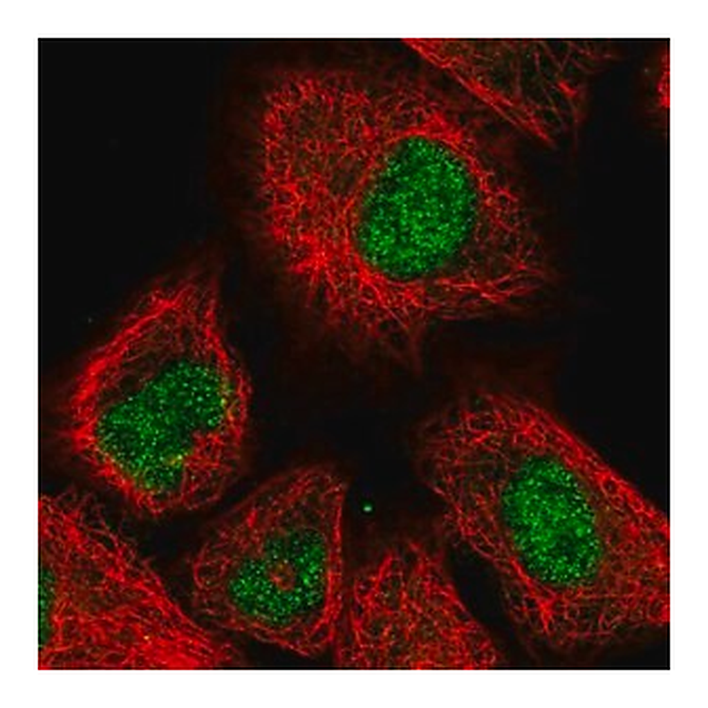Merck Anti-PHC3 antibody produced in rabbit