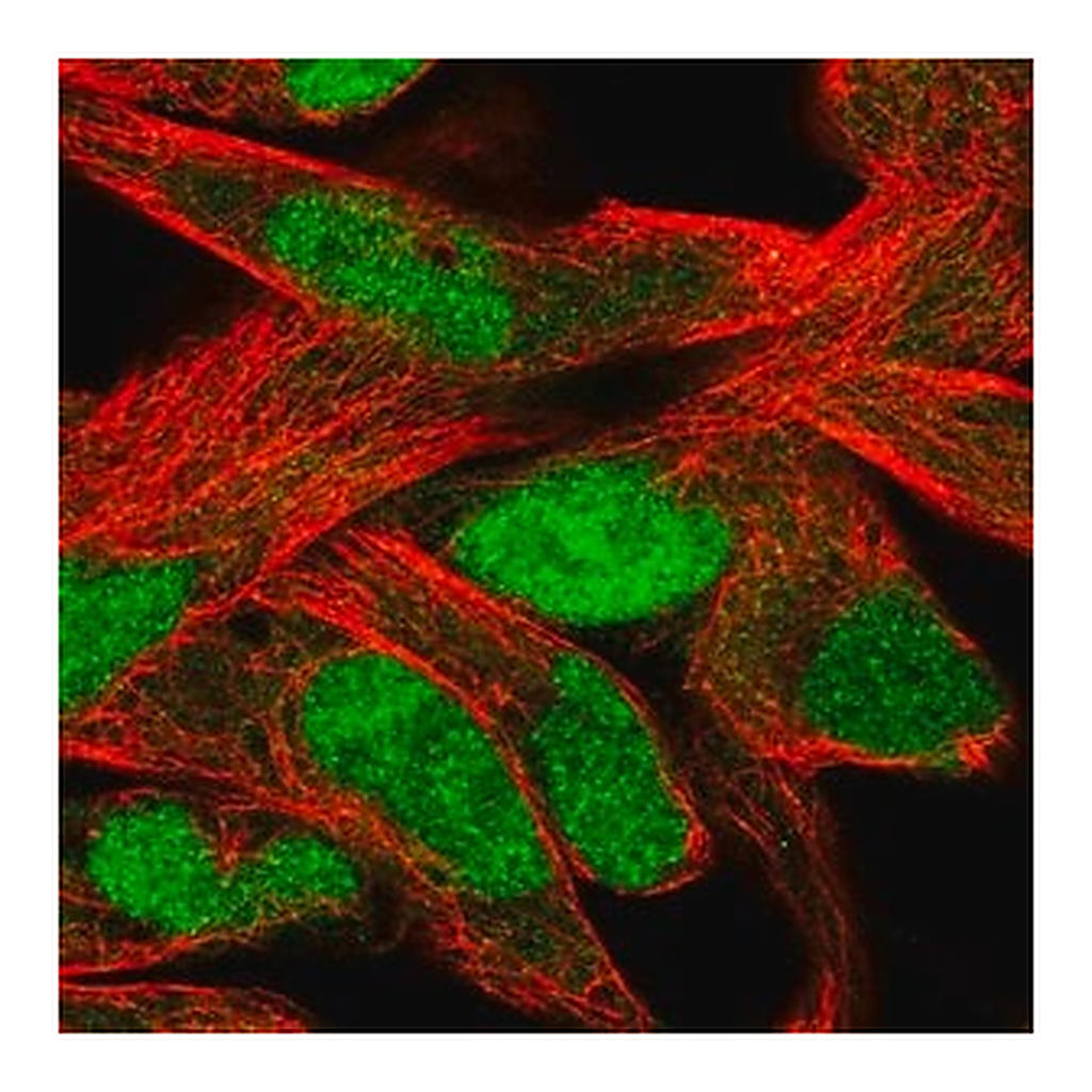 Merck Anti-SLFN11 antibody produced in rabbit
