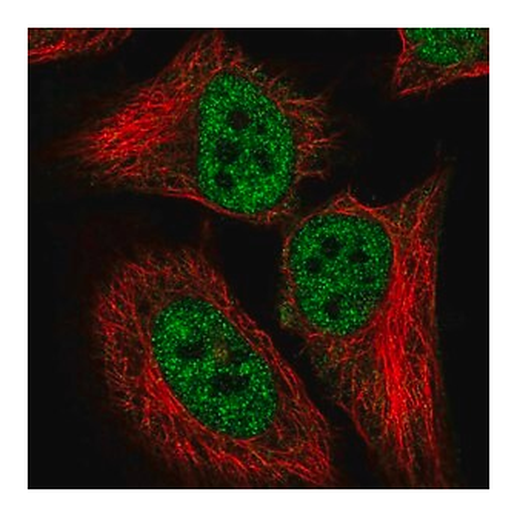 Merck Anti-CDKN2AIP antibody produced in rabbit