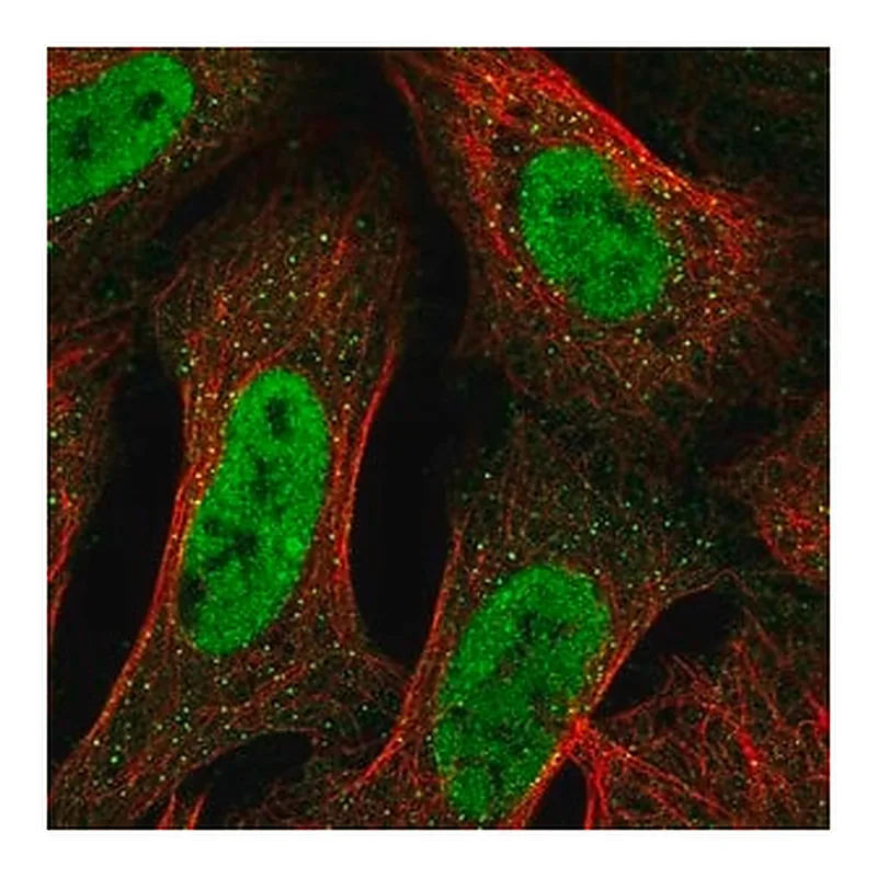 Merck Anti-TRAK2 antibody produced in rabbit