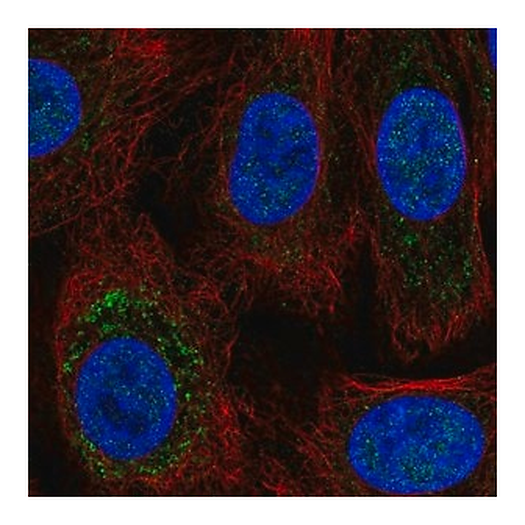 Merck Anti-TRPC6 antibody produced in rabbit