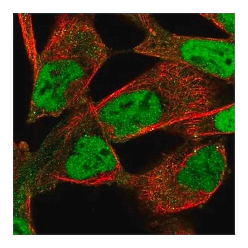 Merck Anti-PIP4K2B antibody produced in rabbit