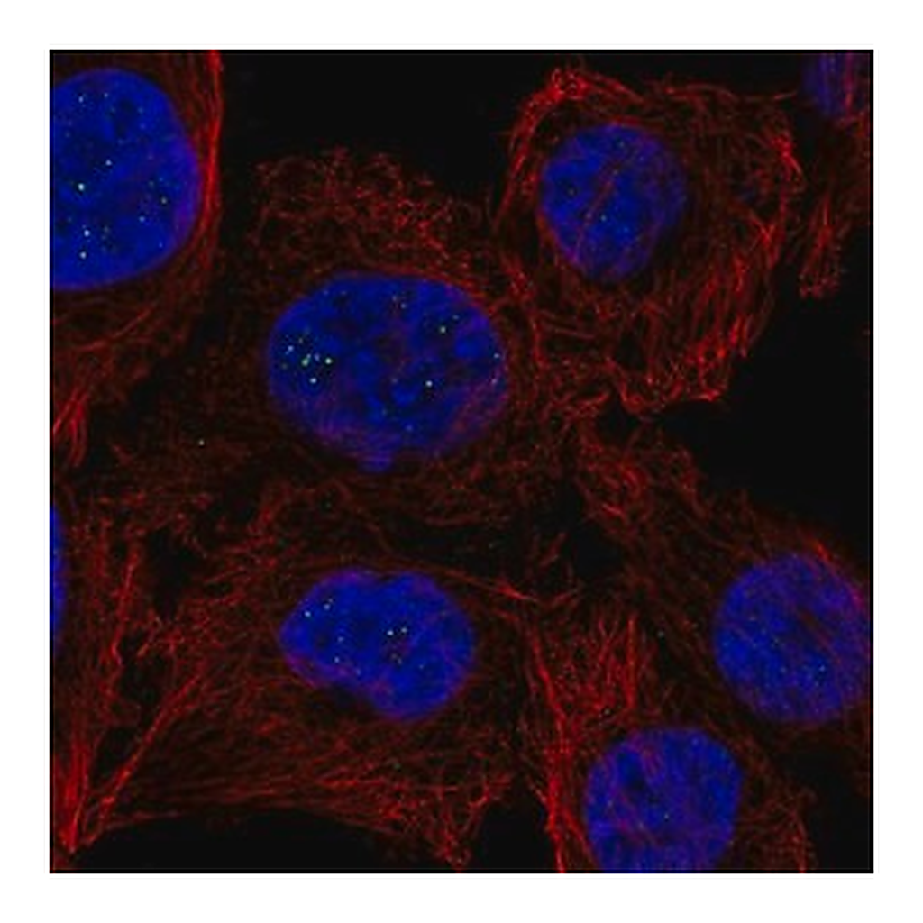 Merck Anti-PPM1M antibody produced in rabbit