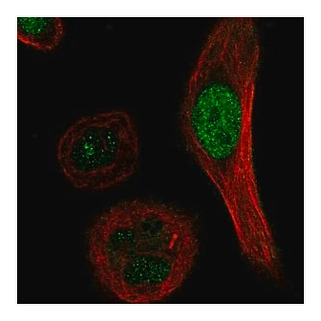 Merck Anti-XRCC3 antibody produced in rabbit