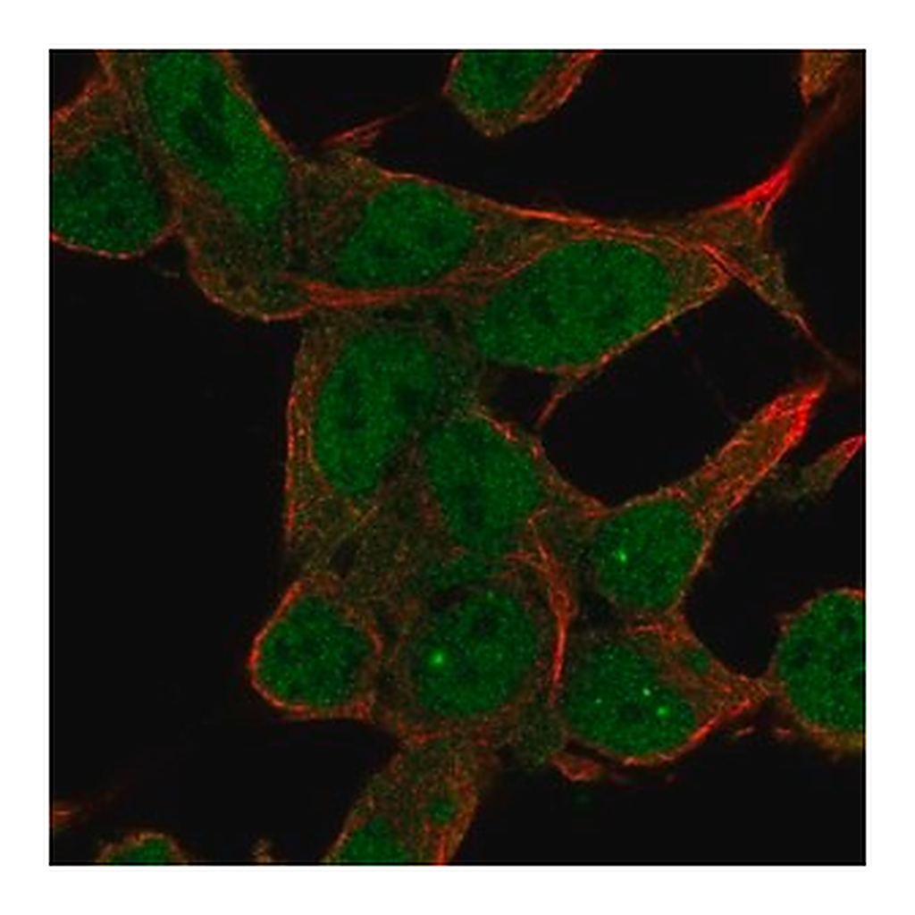 Merck Anti-ZNF829 antibody produced in rabbit