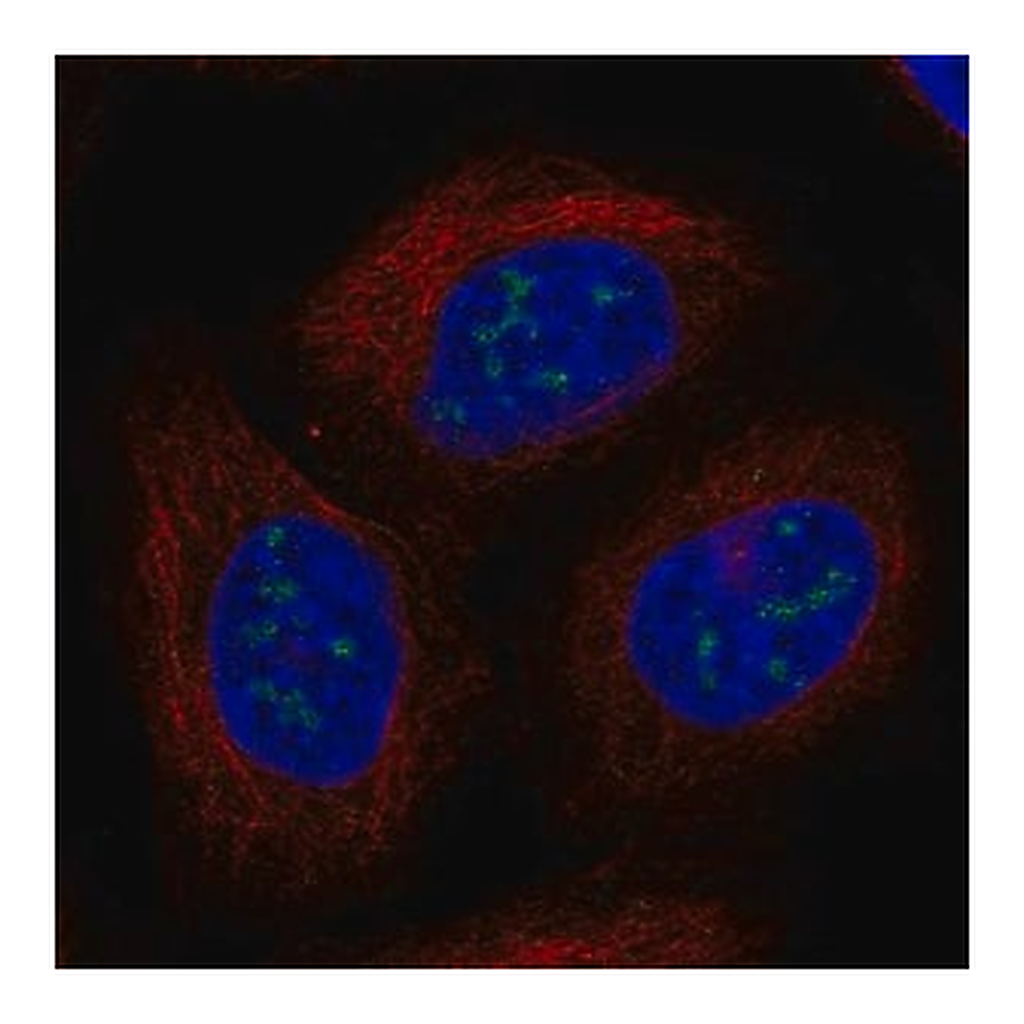 Merck Anti-UBE2W antibody produced in rabbit