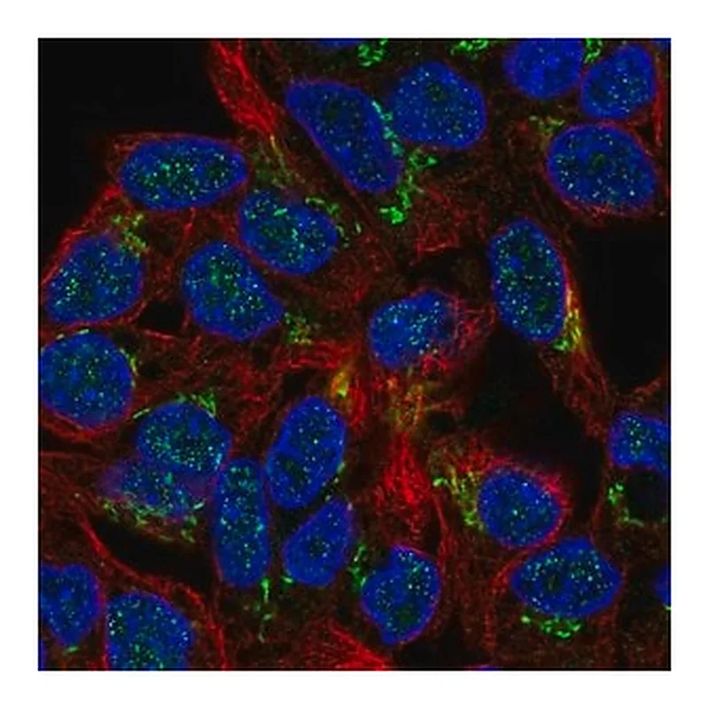 Merck Anti-PHKB antibody produced in rabbit