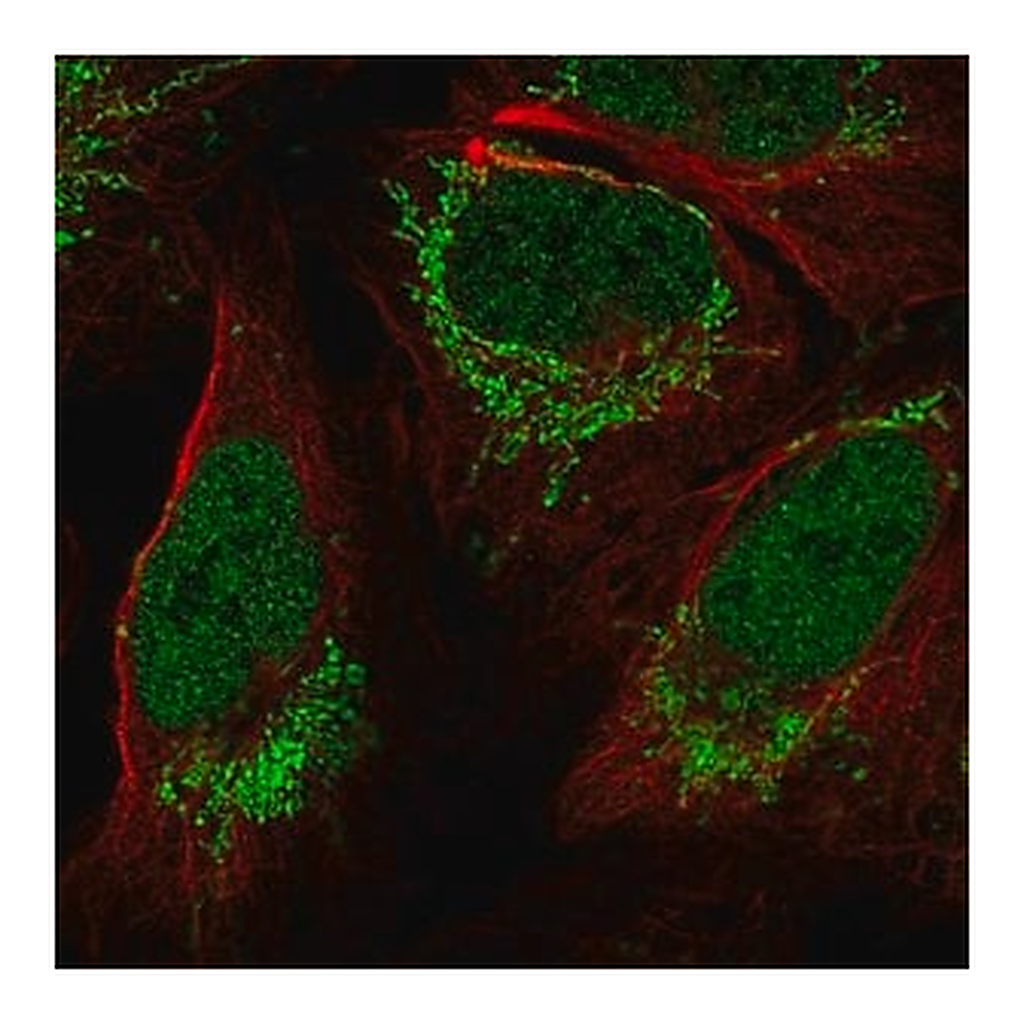 Merck Anti-FOXB1 antibody produced in rabbit