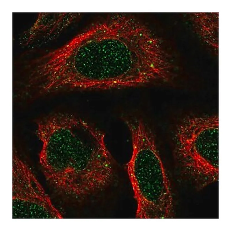 Merck Anti-ACKR2 antibody produced in rabbit