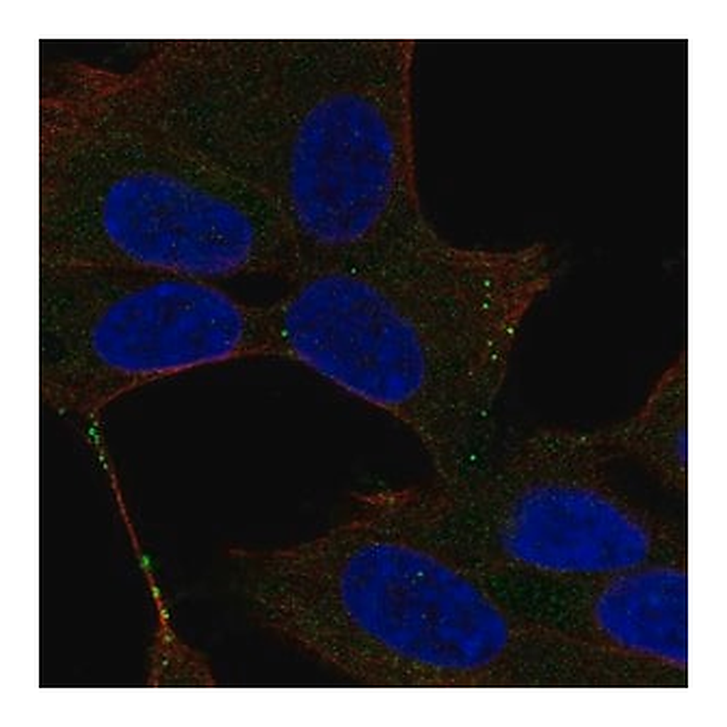 Merck Anti-UNC13D antibody produced in rabbit