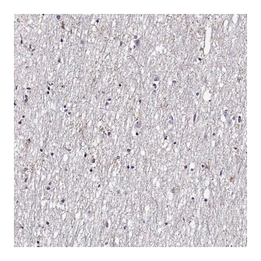 Merck Anti-FEZF1 antibody produced in rabbit
