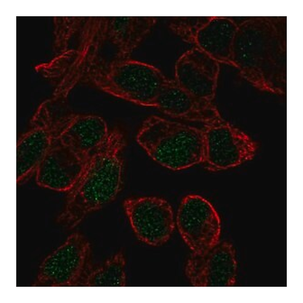 Merck Anti-SOX18 antibody produced in rabbit