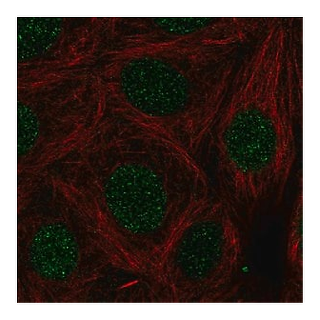 Merck Anti-LMX1B antibody produced in rabbit