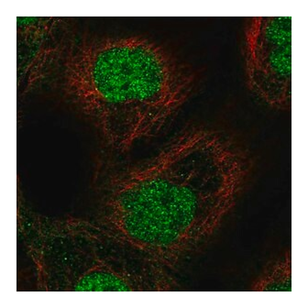 Merck Anti-ETS2 antibody produced in rabbit