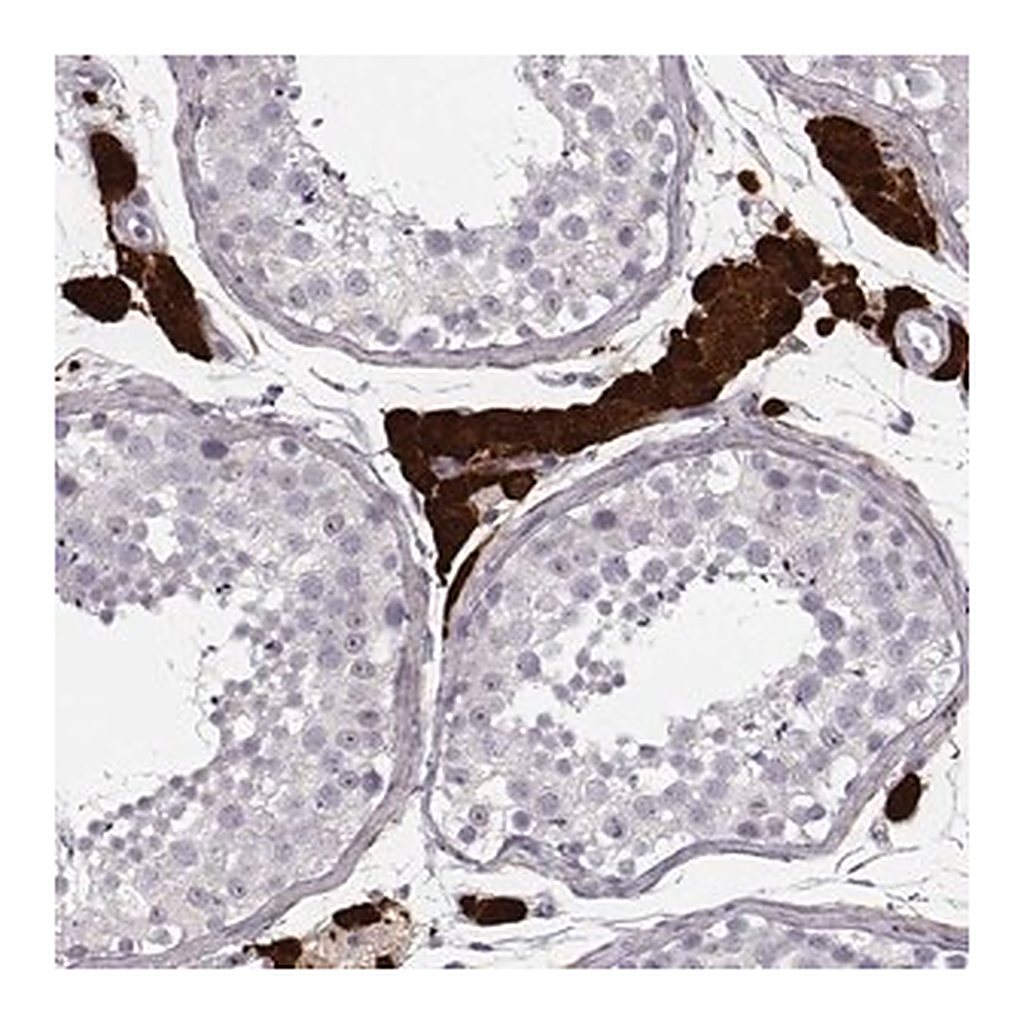 Merck Anti-ZNF433 antibody produced in rabbit