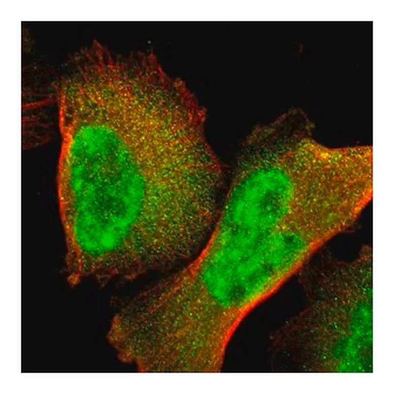 Merck Anti-GTF2E2 antibody produced in rabbit