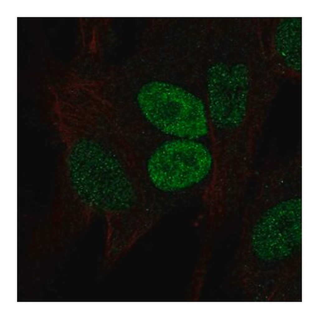 Merck Anti-PRRX2 antibody produced in rabbit