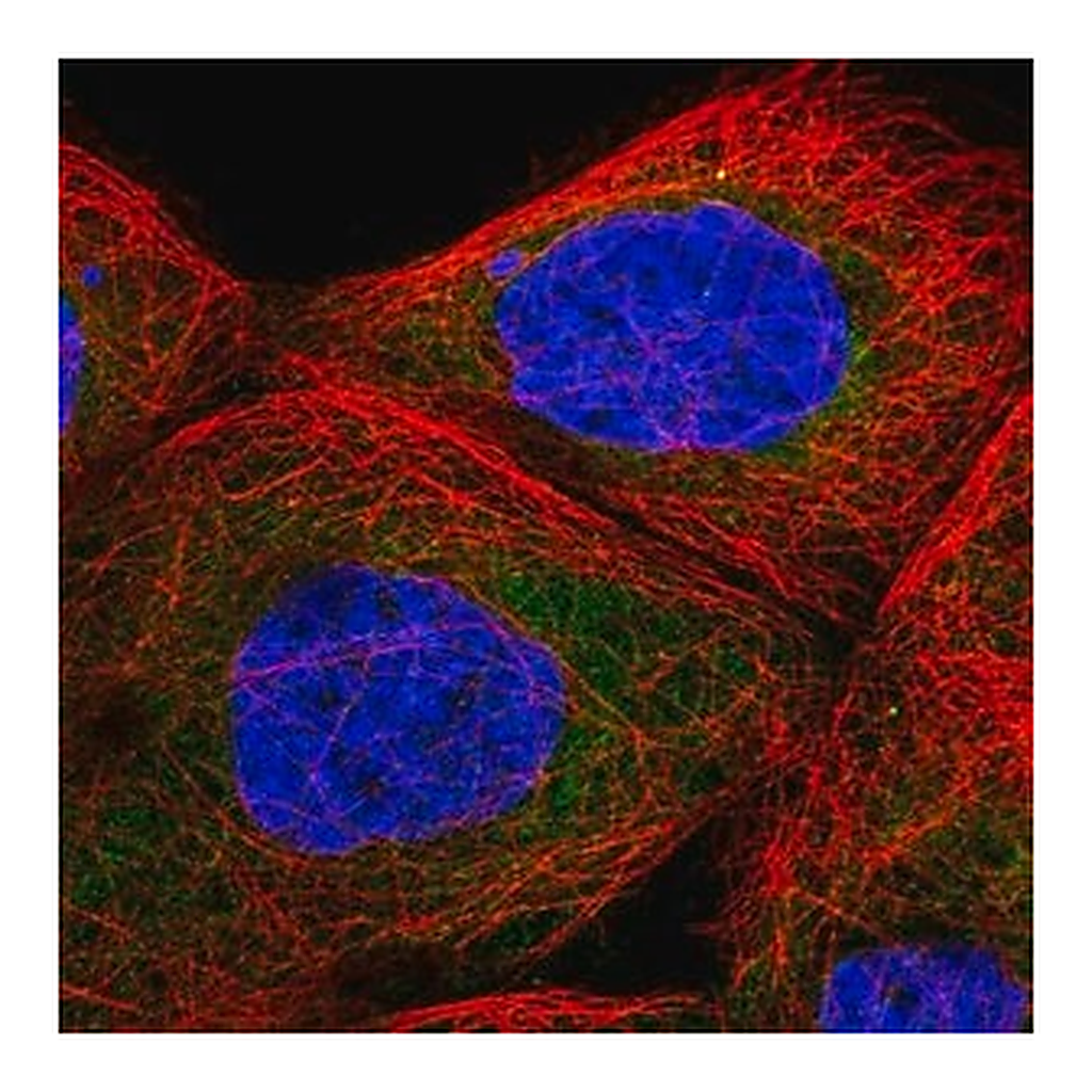 Merck Anti-TBL2 antibody produced in rabbit