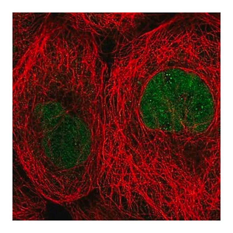 Merck Anti-TBCK antibody produced in rabbit