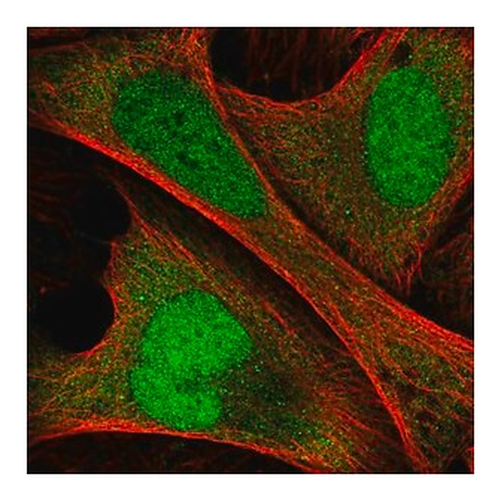 Merck Anti-ANKRD36C antibody produced in rabbit