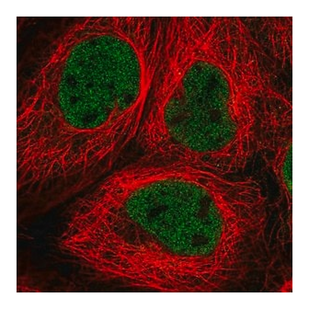 Merck Anti-RNF20 antibody produced in rabbit