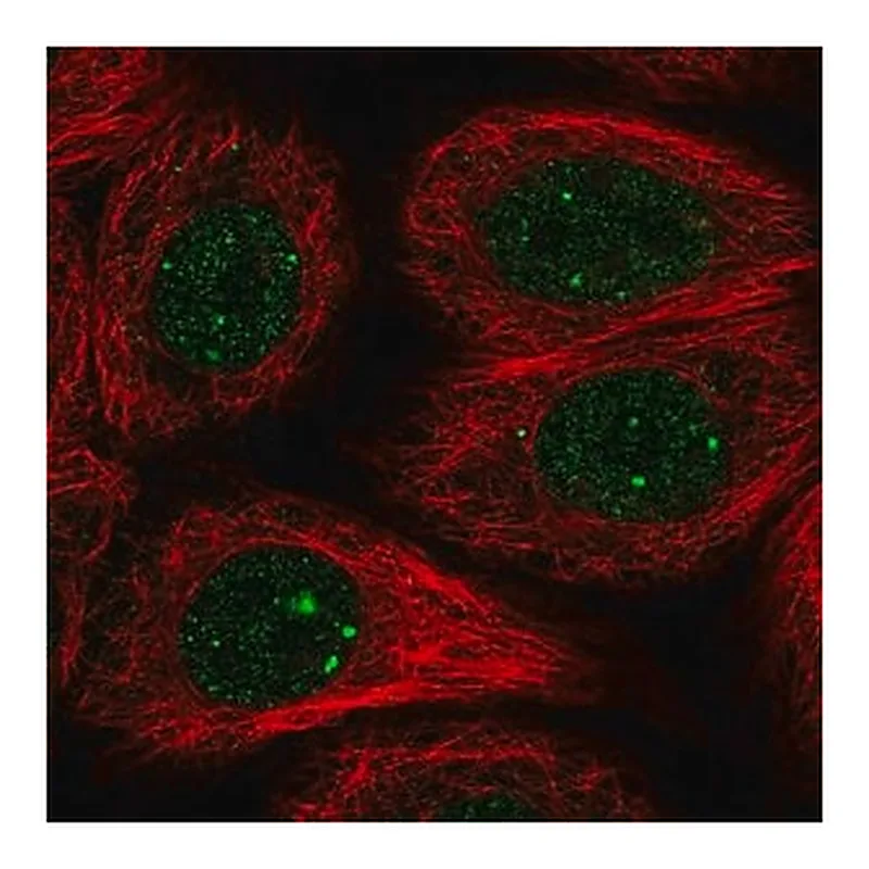 Merck Anti-RAD51B antibody produced in rabbit