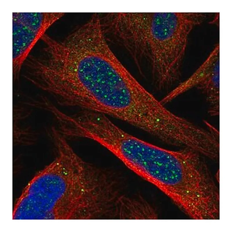 Merck Anti-CHIC1 antibody produced in rabbit