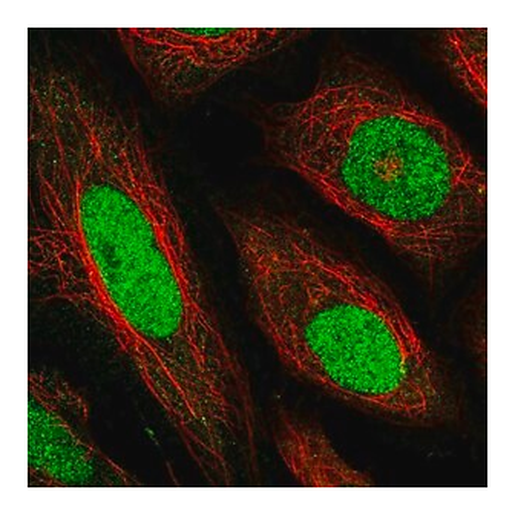 Merck Anti-TEAD1 antibody produced in rabbit
