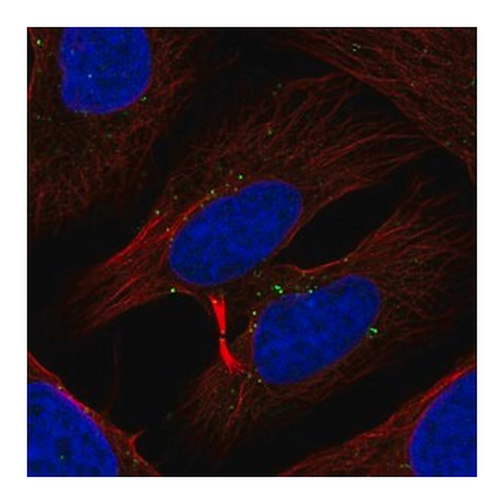 Merck Anti-TXK antibody produced in rabbit