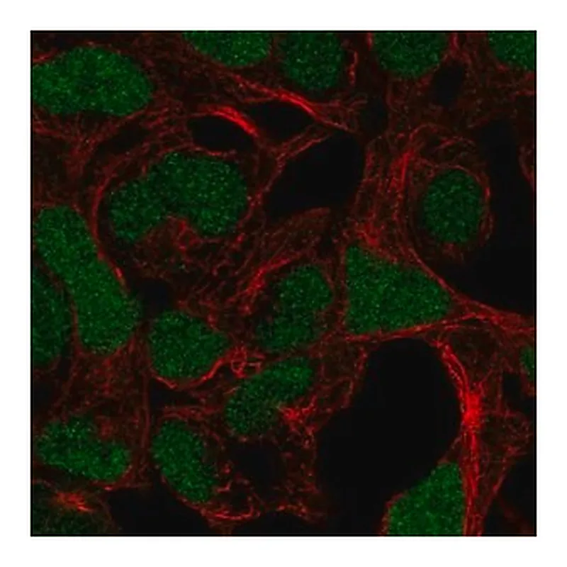 Merck Anti-ADAMTS17 antibody produced in rabbit