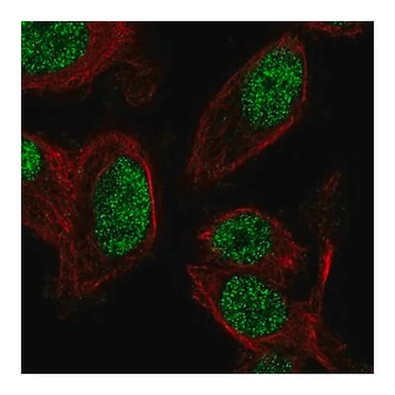 Merck Anti-ZNF672 antibody produced in rabbit