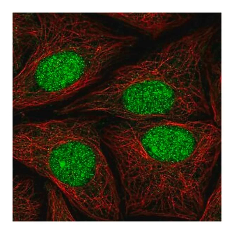 Merck Anti-ATXN1L antibody produced in rabbit