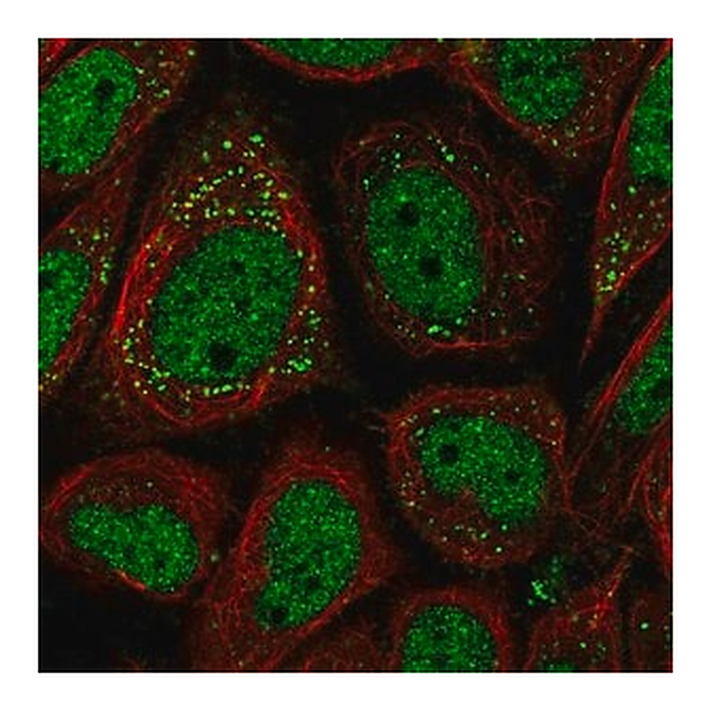 Merck Anti-PNPLA2 antibody produced in rabbit