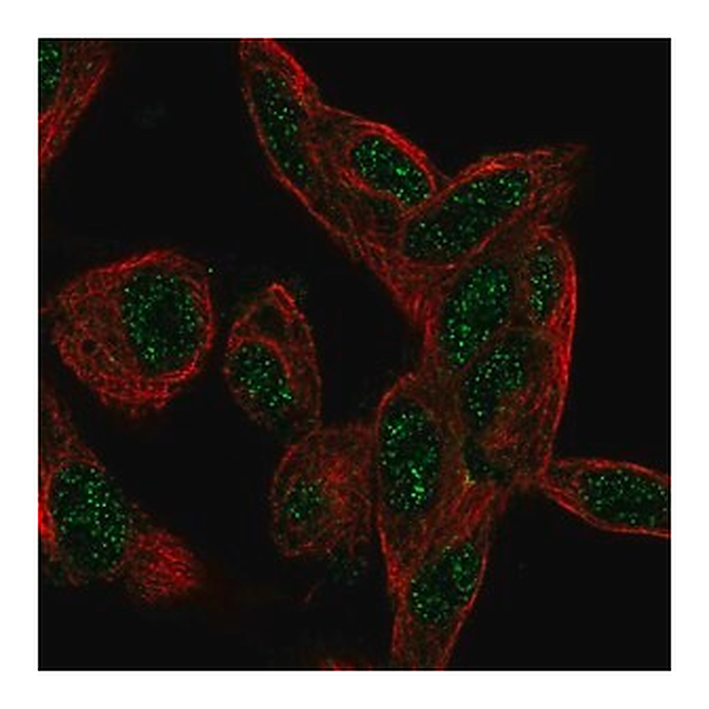 Merck Anti-CTDSP1 antibody produced in rabbit