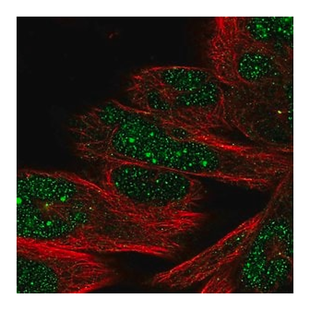 Merck Anti-DHX35 antibody produced in rabbit