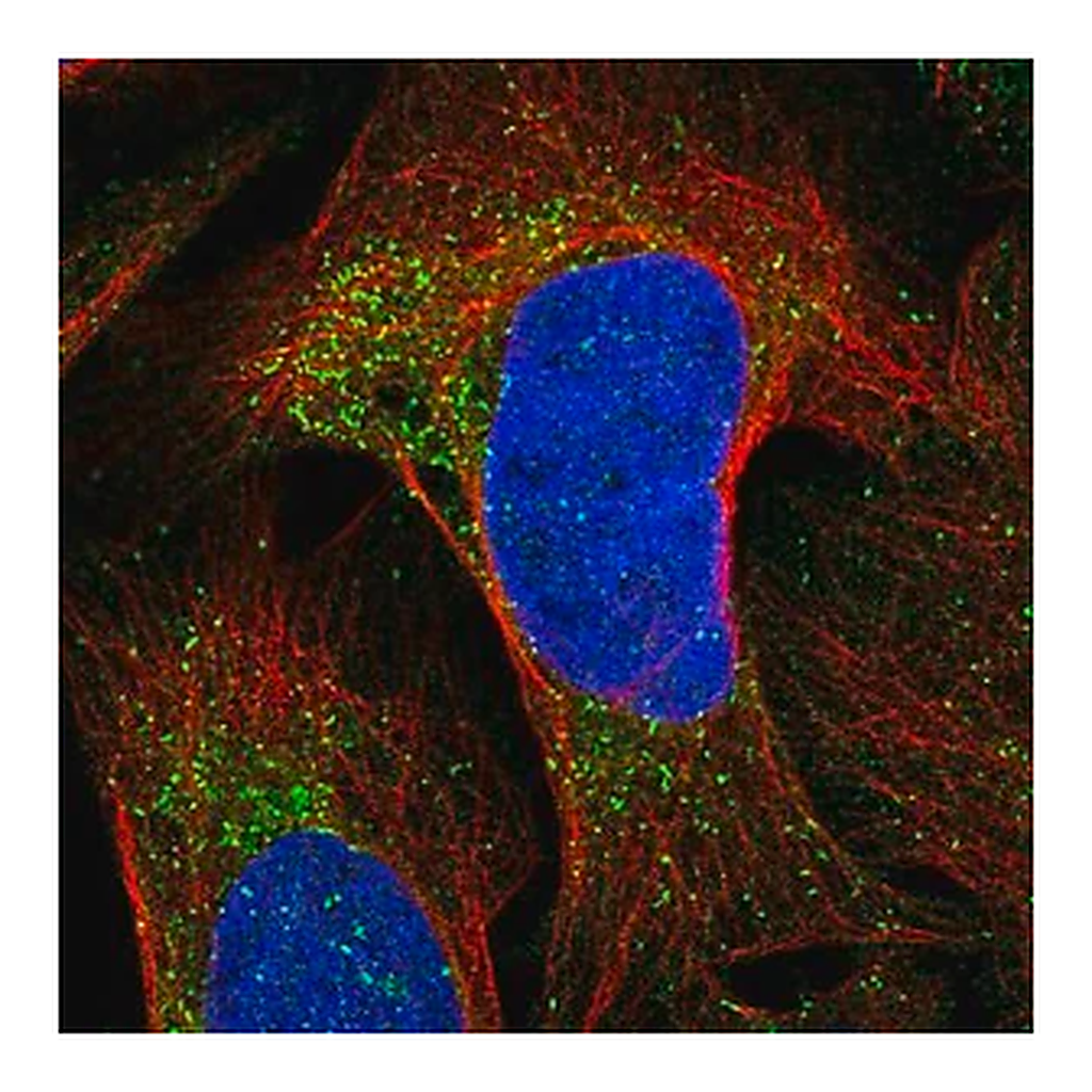 Merck Anti-CKLF antibody produced in rabbit