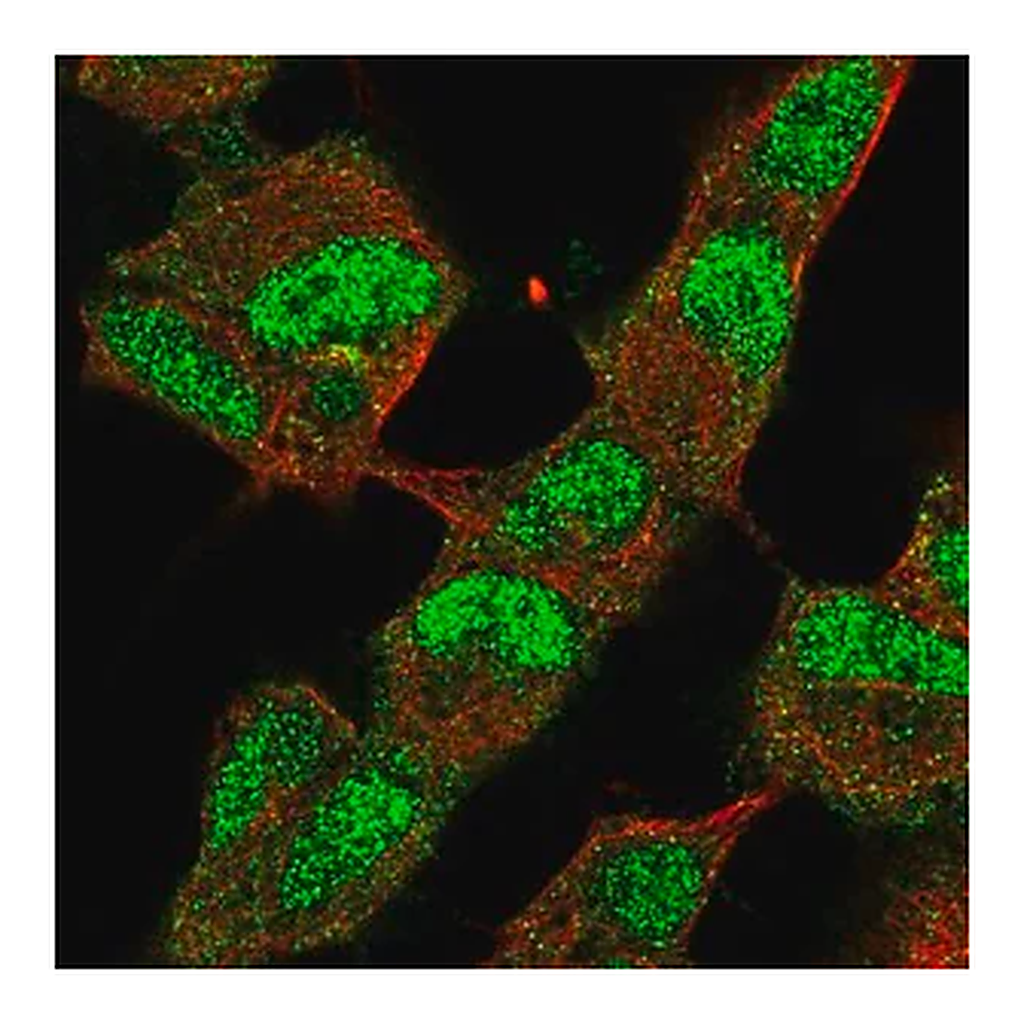 Merck Anti-KDM4B antibody produced in rabbit